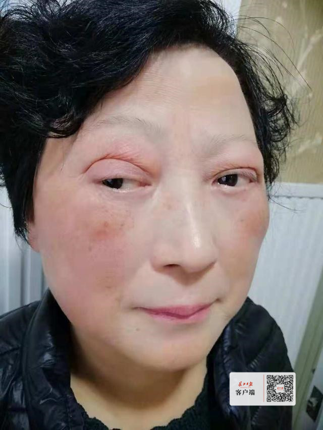割坏双眼皮21年不敢出门的王奶奶终于喜拍婚纱照