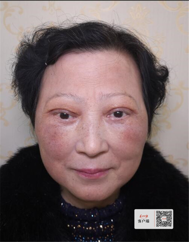 割坏双眼皮21年不敢出门的王奶奶终于喜拍婚纱照
