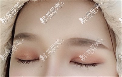 武汉哪里做双眼皮做得好？分享十家双眼皮口碑好的医院