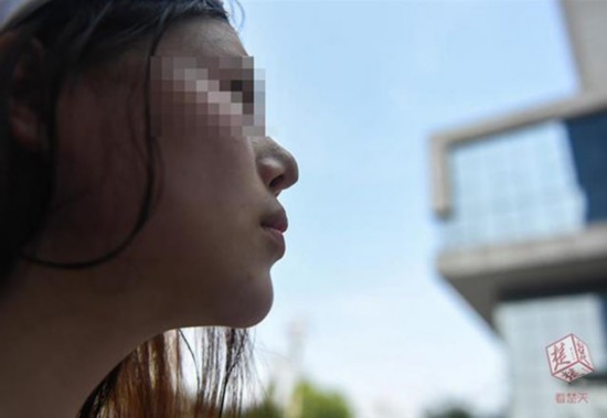 女子38万做隆鼻 款刚还完假体就快要掉出来