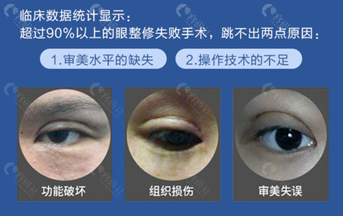 谁找武汉同济医院陈平拉过双眼皮？效果好不好看对比照了解 - 爱美容研社