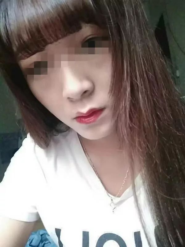 西安一女子割双眼皮割成了三眼皮 医院竟然怪患者眼皮松！