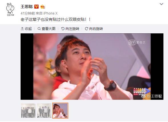 双眼皮贴图片引热议王思聪霸气回应