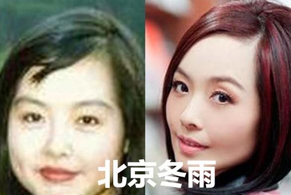 10大漂亮女星打瘦脸针前后容颜拼