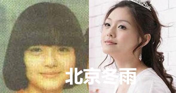 10大漂亮女星打瘦脸针前后容颜拼