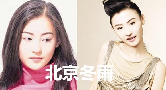 10大漂亮女星打瘦脸针前后容颜拼