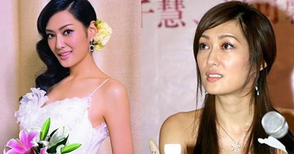 10大漂亮女星打瘦脸针前后容颜拼
