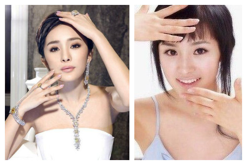 10大漂亮女星打瘦脸针前后容颜拼