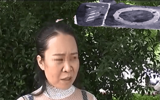 女子借钱做脸部美容手术后没效果美容院：不可能有仙女的效果