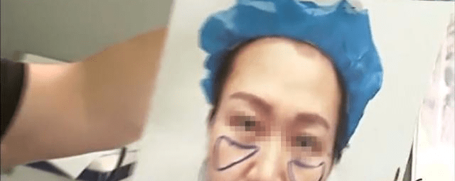 女子借钱做脸部美容手术后没效果美容院：不可能有仙女的效果