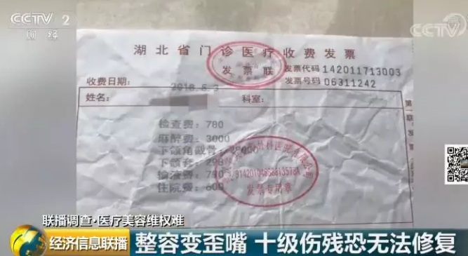 武汉华美整形手术效果怎么样？女子整容变歪嘴十级伤残恐无法修复