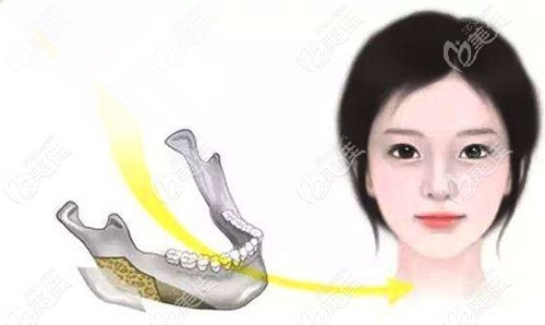 武汉口碑好的整形医院排名：推荐的武汉亚韩艺星仁爱时光口碑好还出名