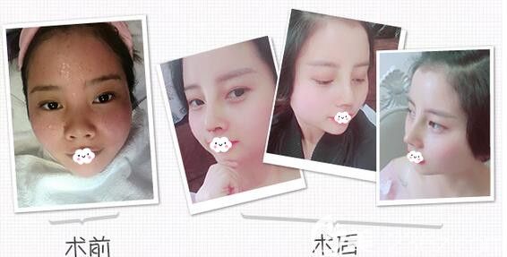 武汉哪家整形医院好？公布武汉口碑好的十大正规整形医院人气网红医生案例与价格表