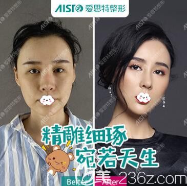 武汉哪家整形医院好？公布武汉口碑好的十大正规整形医院人气网红医生案例与价格表