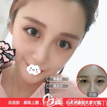 武汉哪家整形医院好？公布武汉口碑好的十大正规整形医院人气网红医生案例与价格表