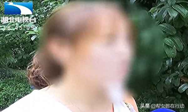 腿部整形需要多少钱请问腿部整形需要多少费用
