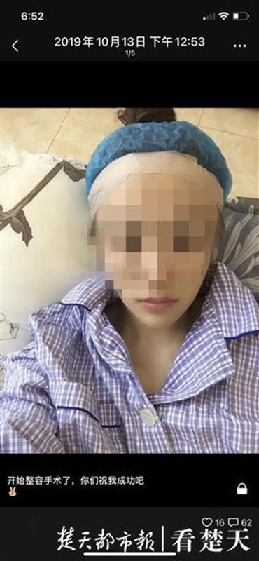 武汉“吉美拉”整形！女子花5万元变美却成这样
