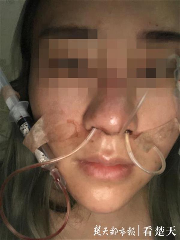 武汉“吉美拉”整形！女子花5万元变美却成这样