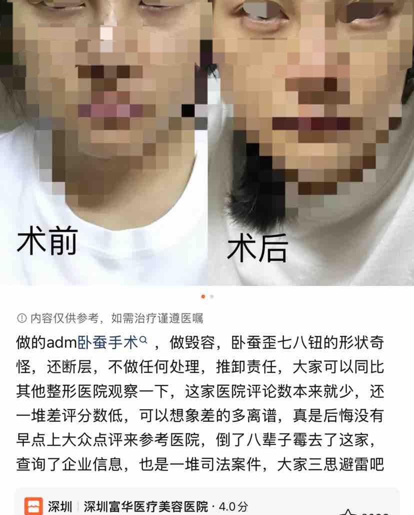 从深圳富华整形的违规诊疗揭开尘封19载的奥美定之殇！