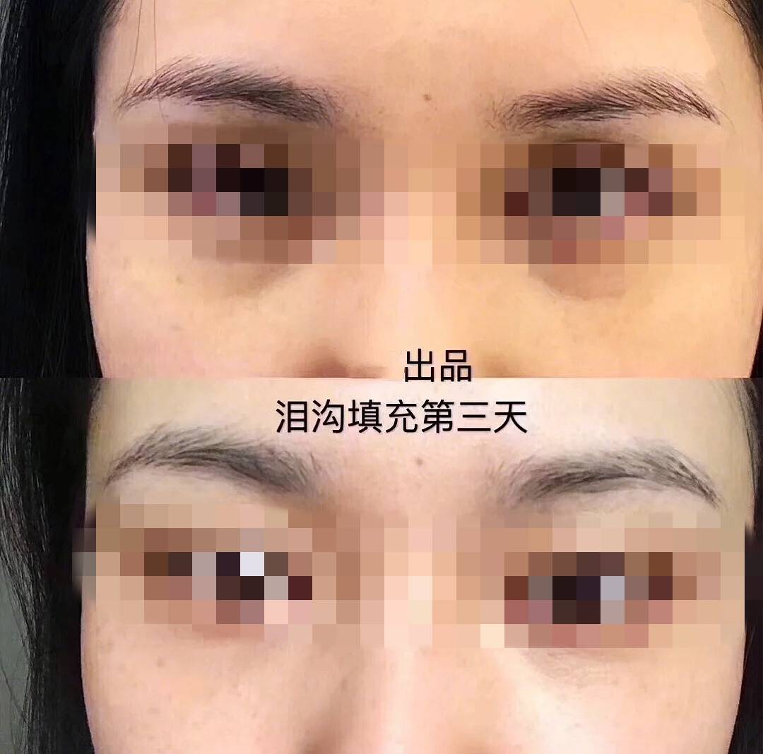 主播圈的颜值由武汉伽美周传波院长点燃