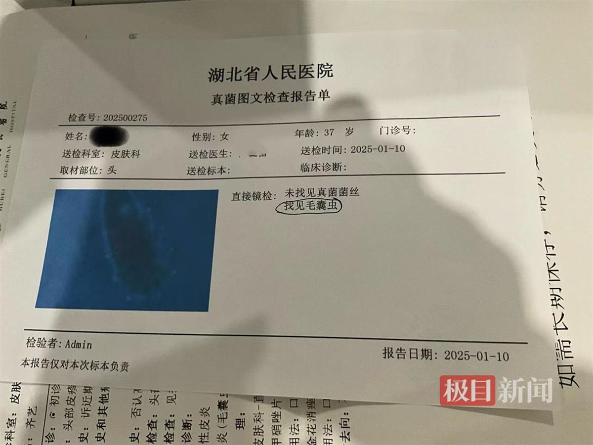 武汉女子花两万固发染上毛囊炎？相关部门已介入